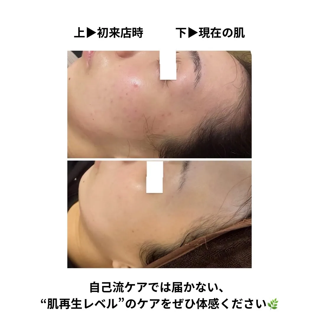 💬お客様のリアルな声💬