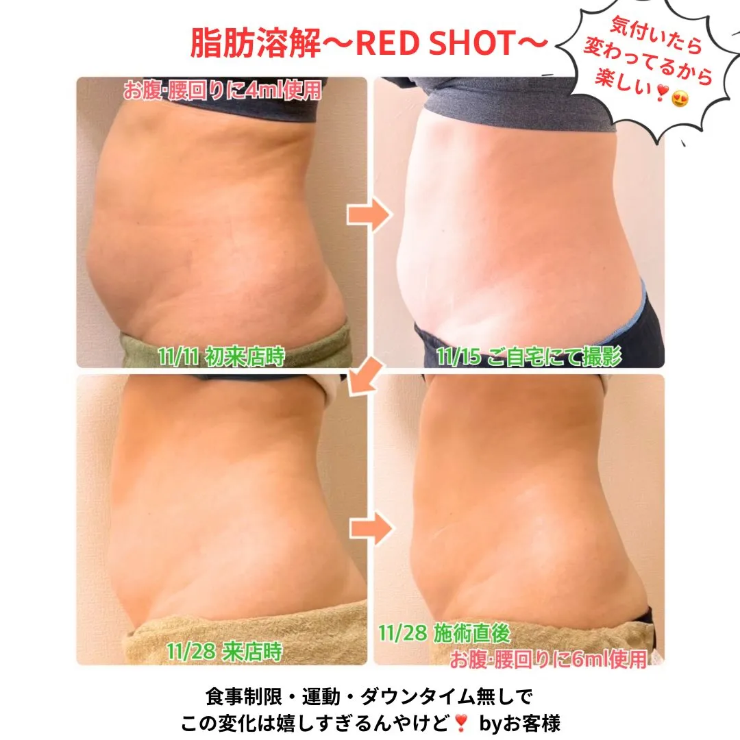 ✨脂肪溶解《RED SHOT》✨