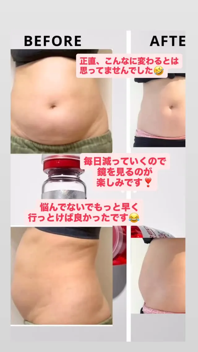 大人気の脂肪溶解🔥RED SHOT