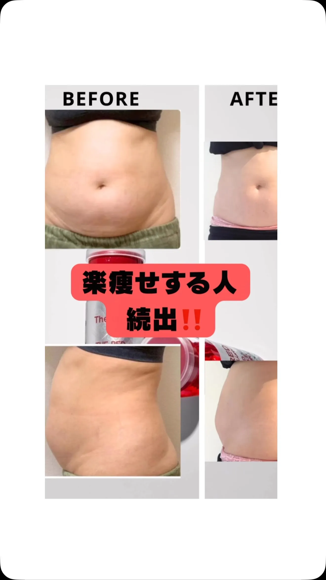 #楽痩せ  #ダイエット  #痩身  #脂肪溶解
